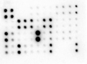 Mouse Atherosclerosis Antibody Array - Membrane (22 targets)