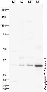 Western blot - Mouse brain tissue lysate - total protein (0 days) (ab7188), expandable thumbnail
