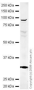 Western blot - Mouse brain tissue lysate - total protein (0 days) (ab7188), expandable thumbnail