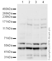 Western blot - Mouse brain tissue lysate - total protein (0 days) (ab7188), expandable thumbnail