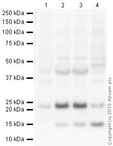 Western blot - Mouse brain tissue lysate - total protein (0 days) (AB7188)
