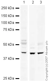 Western blot - Mouse colon tissue lysate - total protein (AB29544)