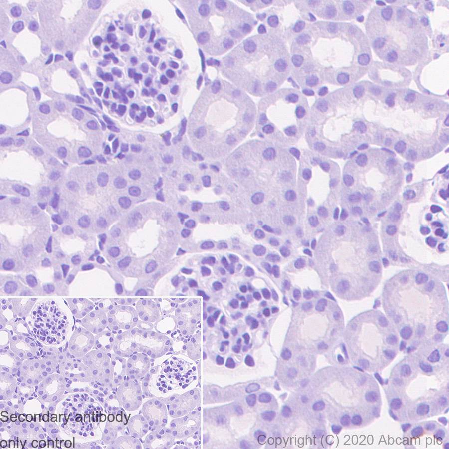 Immunohistochemistry (Formalin/PFA-fixed paraffin-embedded sections) - Mouse IgG1 monoclonal [R312-MouseIgG1]-Isotype control (AB280974), expandable thumbnail