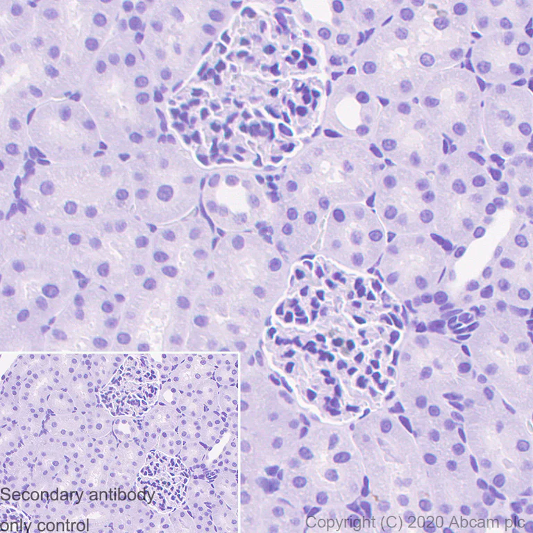 Immunohistochemistry (Formalin/PFA-fixed paraffin-embedded sections) - Mouse IgG1 monoclonal [R312-MouseIgG1]-Isotype control (AB280974)