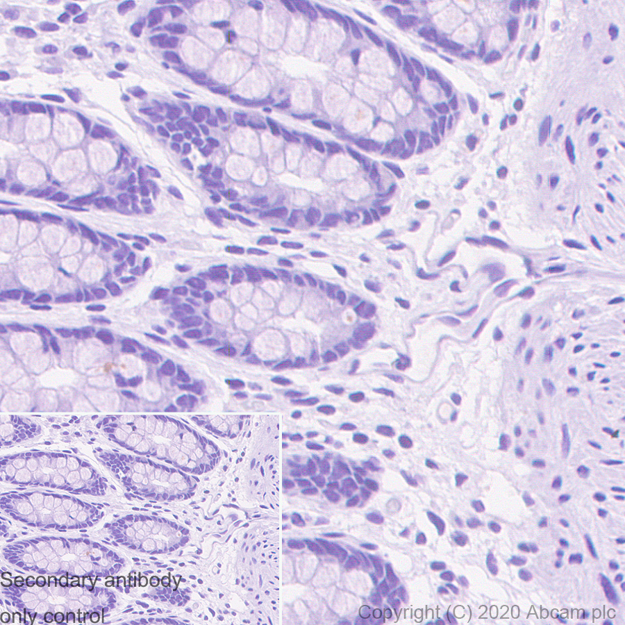 Immunohistochemistry (Formalin/PFA-fixed paraffin-embedded sections) - Mouse IgG1 monoclonal [R312-MouseIgG1]-Isotype control (AB280974), expandable thumbnail