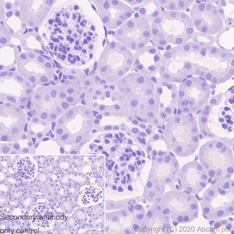 Immunohistochemistry (Formalin/PFA-fixed paraffin-embedded sections) - Mouse IgG1 monoclonal [R312-MouseIgG1]-Isotype control - BSA and Azide free (AB281291)