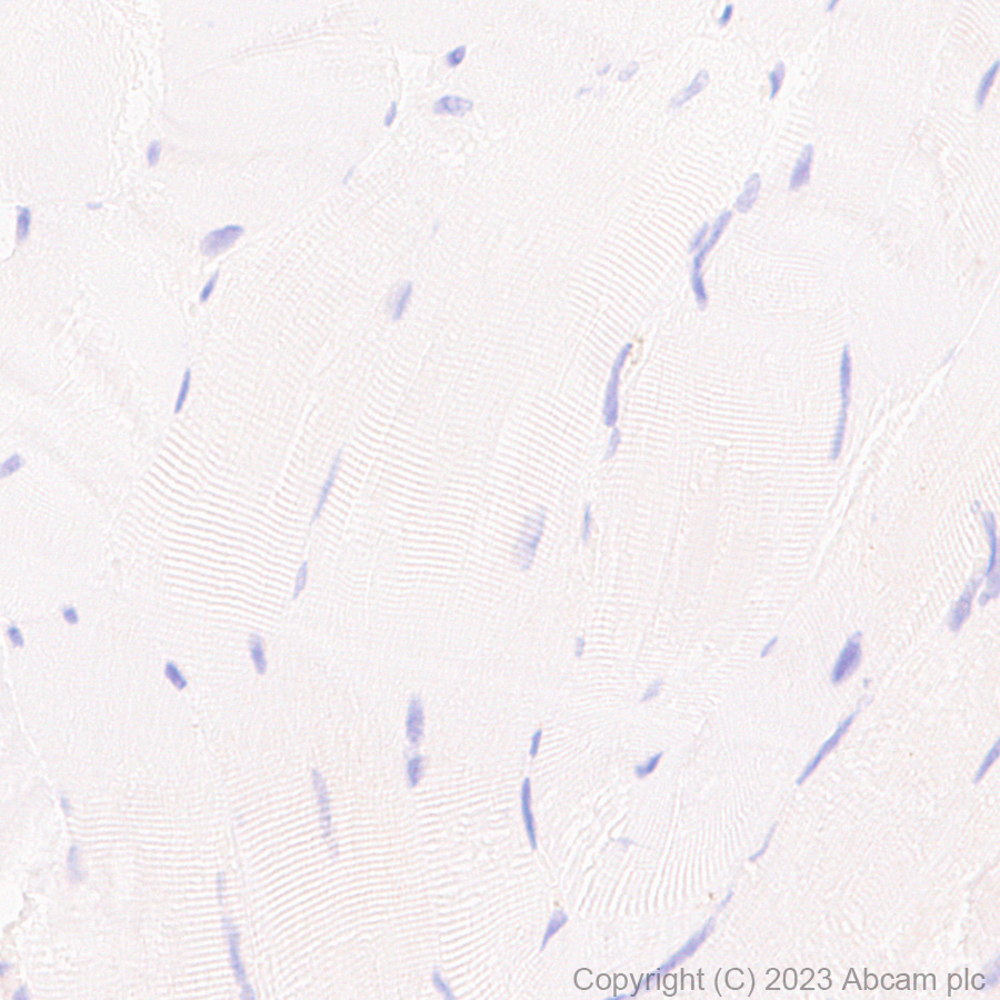 Immunohistochemistry (Formalin/PFA-fixed paraffin-embedded sections) - Anti-Mouse IgG2b antibody [RM108] (AB190482)
