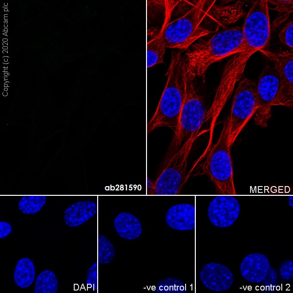 Immunocytochemistry/ Immunofluorescence - Mouse IgG2b monoclonal [R311-MouseIgG2b] - Isotype control (AB281590), expandable thumbnail