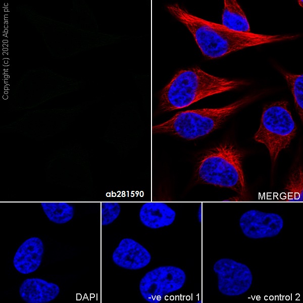 Immunocytochemistry/ Immunofluorescence - Mouse IgG2b monoclonal [R311-MouseIgG2b] - Isotype control (AB281590), expandable thumbnail