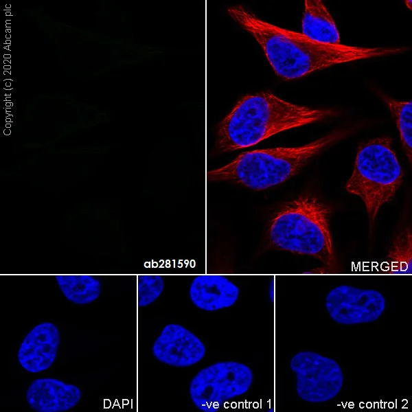 Immunocytochemistry/ Immunofluorescence - Mouse IgG2b monoclonal [R311-MouseIgG2b] - Isotype control (AB281590)
