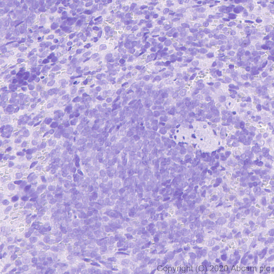 Immunohistochemistry (Formalin/PFA-fixed paraffin-embedded sections) - Mouse IgG2b monoclonal [R311-MouseIgG2b] - Isotype control (ab281590), expandable thumbnail
