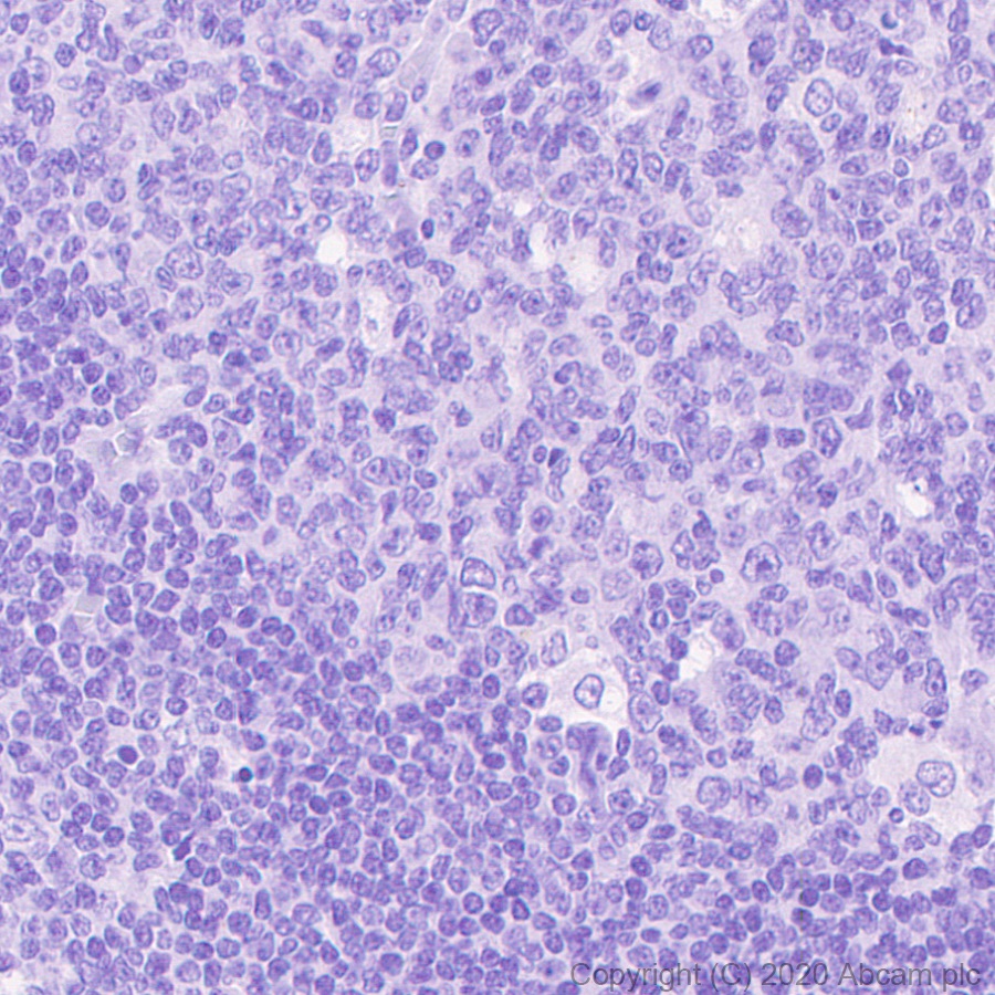 Immunohistochemistry (Formalin/PFA-fixed paraffin-embedded sections) - Mouse IgG2b monoclonal [R311-MouseIgG2b] - Isotype control (AB281590), expandable thumbnail