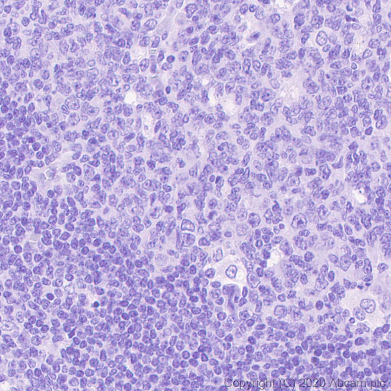 Immunohistochemistry (Formalin/PFA-fixed paraffin-embedded sections) - Mouse IgG2b monoclonal [R311-MouseIgG2b] - Isotype control (AB281590)