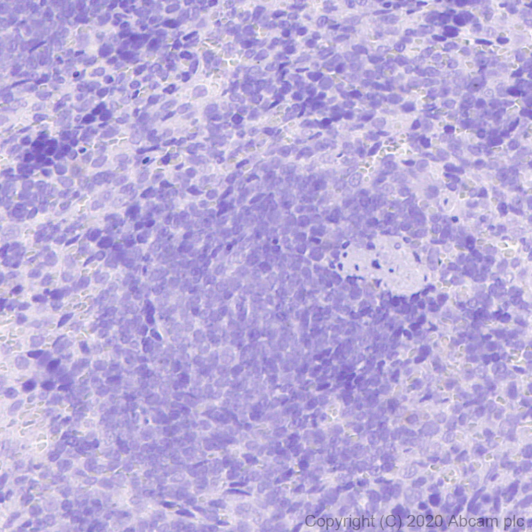 Immunohistochemistry (Formalin/PFA-fixed paraffin-embedded sections) - Mouse IgG2b monoclonal [R311-MouseIgG2b] - Isotype control - BSA and Azide free (AB281638)