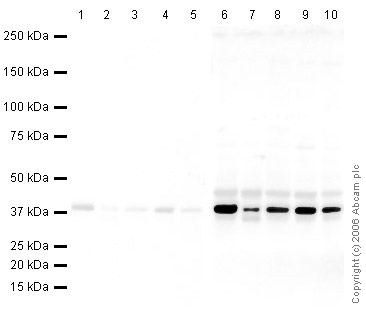 Western blot - Mouse Loading Control Antibody Panel (AB199713), expandable thumbnail