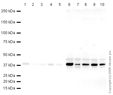 Western blot - Mouse Loading Control Antibody Panel (AB199713)