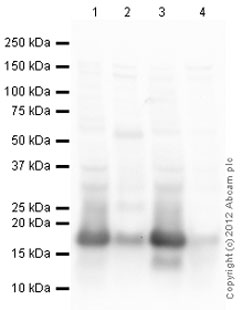 Western blot - Mouse Loading Control Antibody Panel (AB199713), expandable thumbnail