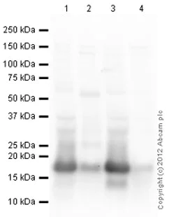 Western blot - Mouse Loading Control Antibody Panel (AB199713)