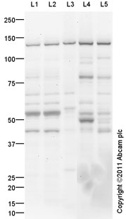 Western blot - Mouse lung normal tissue lysate - total protein (ab29297), expandable thumbnail