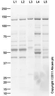 Western blot - Mouse lung normal tissue lysate - total protein (AB29297)