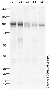 Western blot - Mouse lung normal tissue lysate - total protein (ab29297), expandable thumbnail