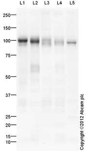 Western blot - Mouse lung normal tissue lysate - total protein (AB29297)