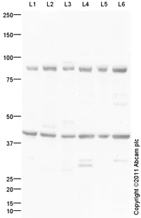 Western blot - Mouse lung normal tissue lysate - total protein (AB29297)