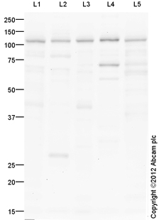 Western blot - Mouse lung normal tissue lysate - total protein (AB29297), expandable thumbnail
