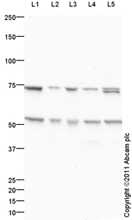 Western blot - Mouse lung normal tissue lysate - total protein (AB29297), expandable thumbnail