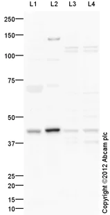Western blot - Mouse lung normal tissue lysate - total protein (AB29297)
