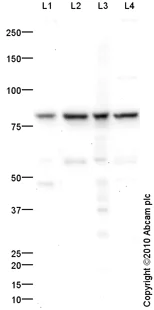 Western blot - Mouse lung normal tissue lysate - total protein (AB29297)