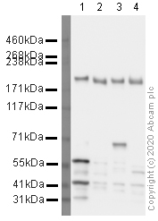Western blot - Mouse lung normal tissue lysate - total protein (ab29297), expandable thumbnail