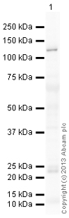 Western blot - Mouse lung normal tissue lysate - total protein (ab29297), expandable thumbnail