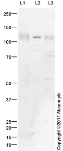 Western blot - Mouse lung normal tissue lysate - total protein (ab29297), expandable thumbnail