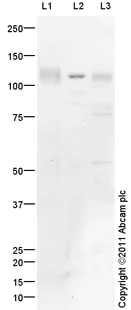 Western blot - Mouse lung normal tissue lysate - total protein (AB29297)