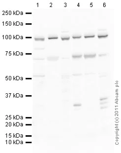 Western blot - Mouse lung normal tissue lysate - total protein (AB29297)