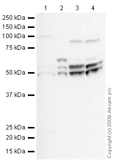 Western blot - Mouse lung normal tissue lysate - total protein (AB29297)