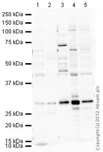 Western blot - Mouse lung normal tissue lysate - total protein (ab29297), expandable thumbnail