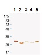 Western blot - Mouse monoclonal [KT100] Anti-Rat IgG+IgM light chain (HRP) (AB106762)