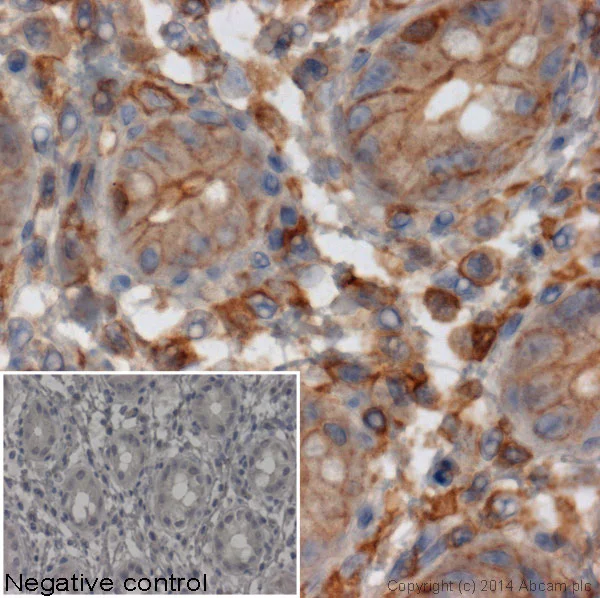Immunohistochemistry (Formalin/PFA-fixed paraffin-embedded sections) - Mouse monoclonal [SB62a] Anti-Rabbit IgG light chain (HRP) (AB99697)