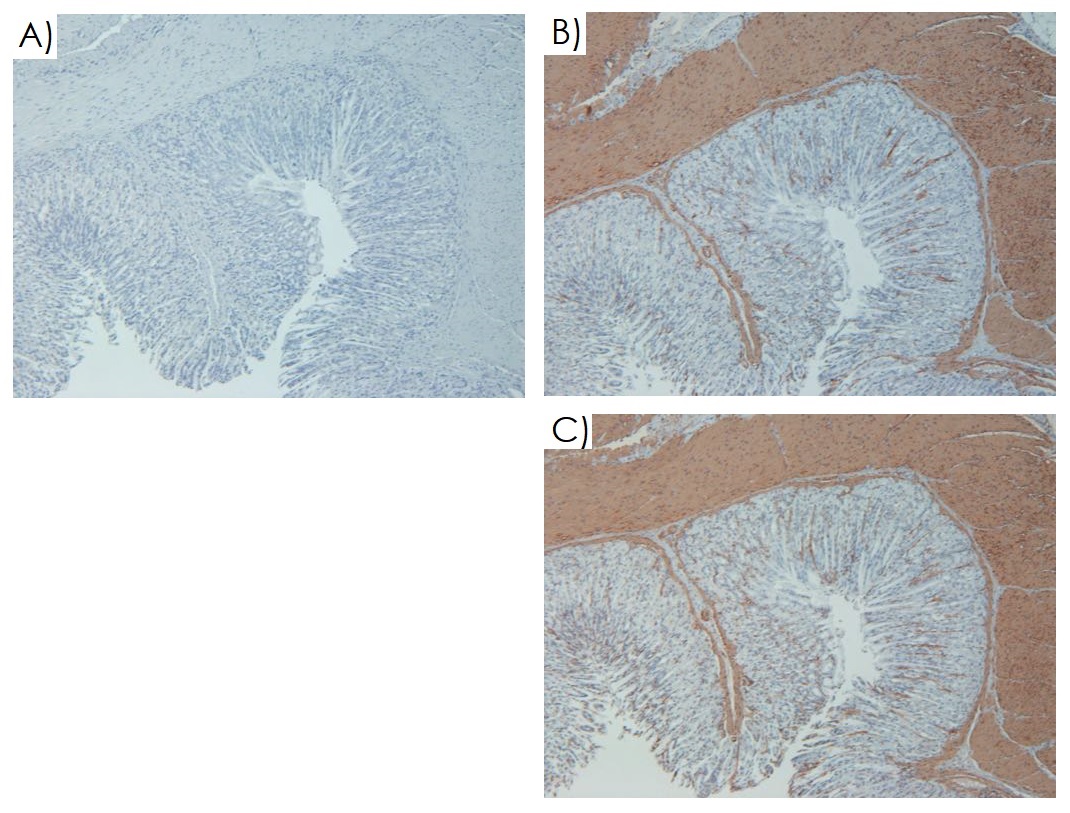 Immunohistochemistry (Formalin/PFA-fixed paraffin-embedded sections) - Mouse on Mouse Polymer IHC Kit (AB269452), expandable thumbnail