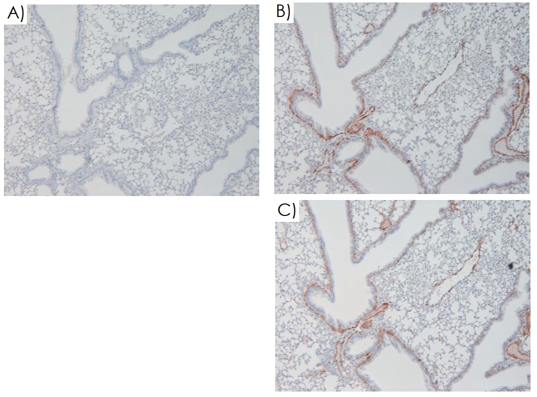 Immunohistochemistry (Formalin/PFA-fixed paraffin-embedded sections) - Mouse on Mouse Polymer IHC Kit (AB269452), expandable thumbnail