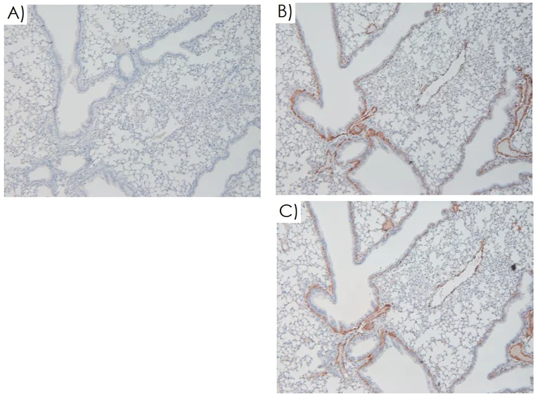 Immunohistochemistry (Formalin/PFA-fixed paraffin-embedded sections) - Mouse on Mouse Polymer IHC Kit (AB269452)
