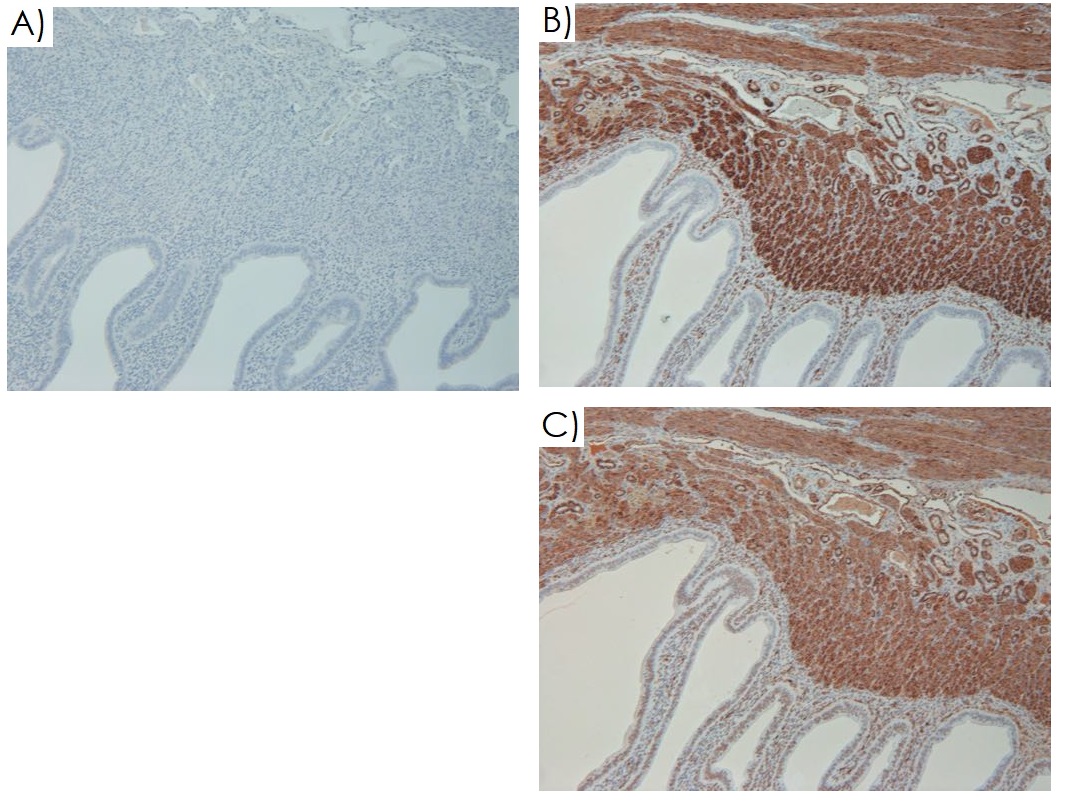 Immunohistochemistry (Formalin/PFA-fixed paraffin-embedded sections) - Mouse on Mouse Polymer IHC Kit (AB269452), expandable thumbnail