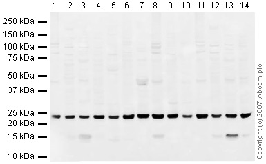 Western blot - Mouse pancreas tissue lysate - total protein (AB29363), expandable thumbnail