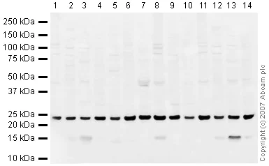 Western blot - Mouse pancreas tissue lysate - total protein (AB29363)
