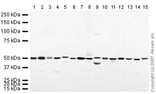 Western blot - Mouse pancreas tissue lysate - total protein (ab29363), expandable thumbnail