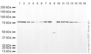 Western blot - Mouse pancreas tissue lysate - total protein (AB29363), expandable thumbnail