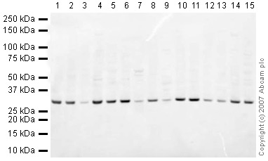 Western blot - Mouse pancreas tissue lysate - total protein (AB29363), expandable thumbnail