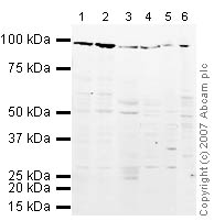 Western blot - Mouse pancreas tissue lysate - total protein (ab29363), expandable thumbnail